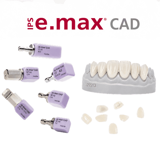PMMA provisional restoration