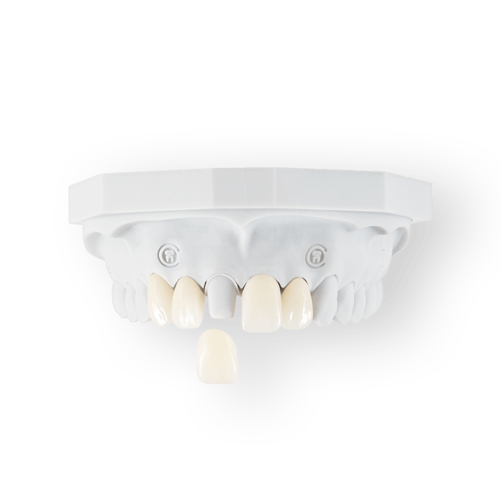Crowns and Bridges