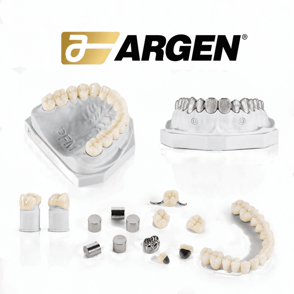 PFM Maryland Bridge (Argen® alloy)