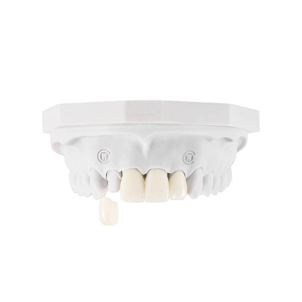 Veneers gallery image 1
