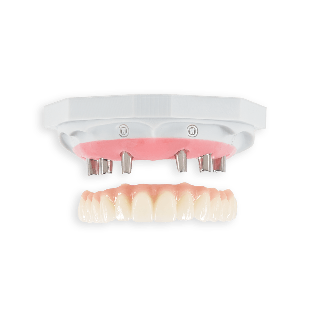 Cement-retained implant restoration