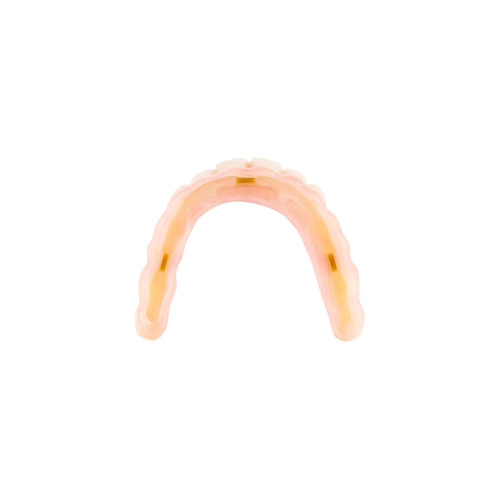NeoClip™ gallery image 3