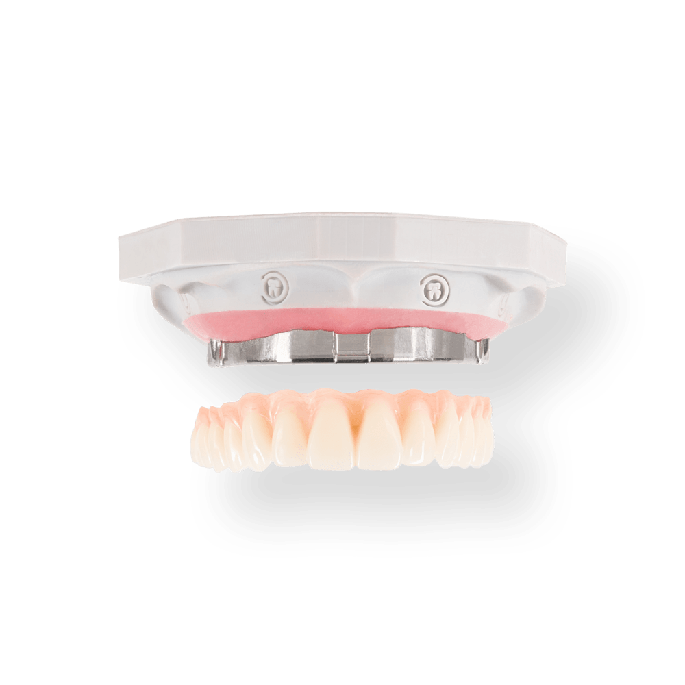NeoClip restoration