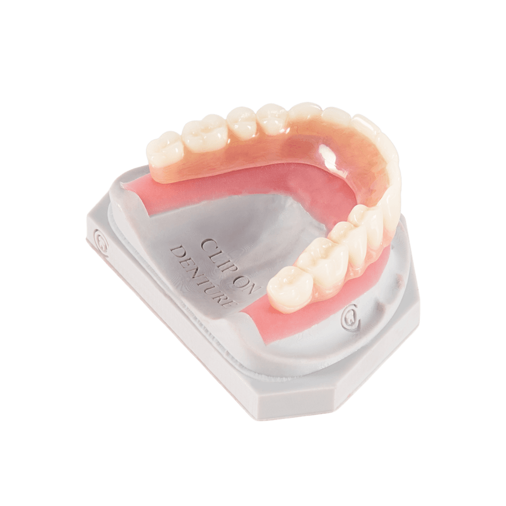 Clip-On Denture