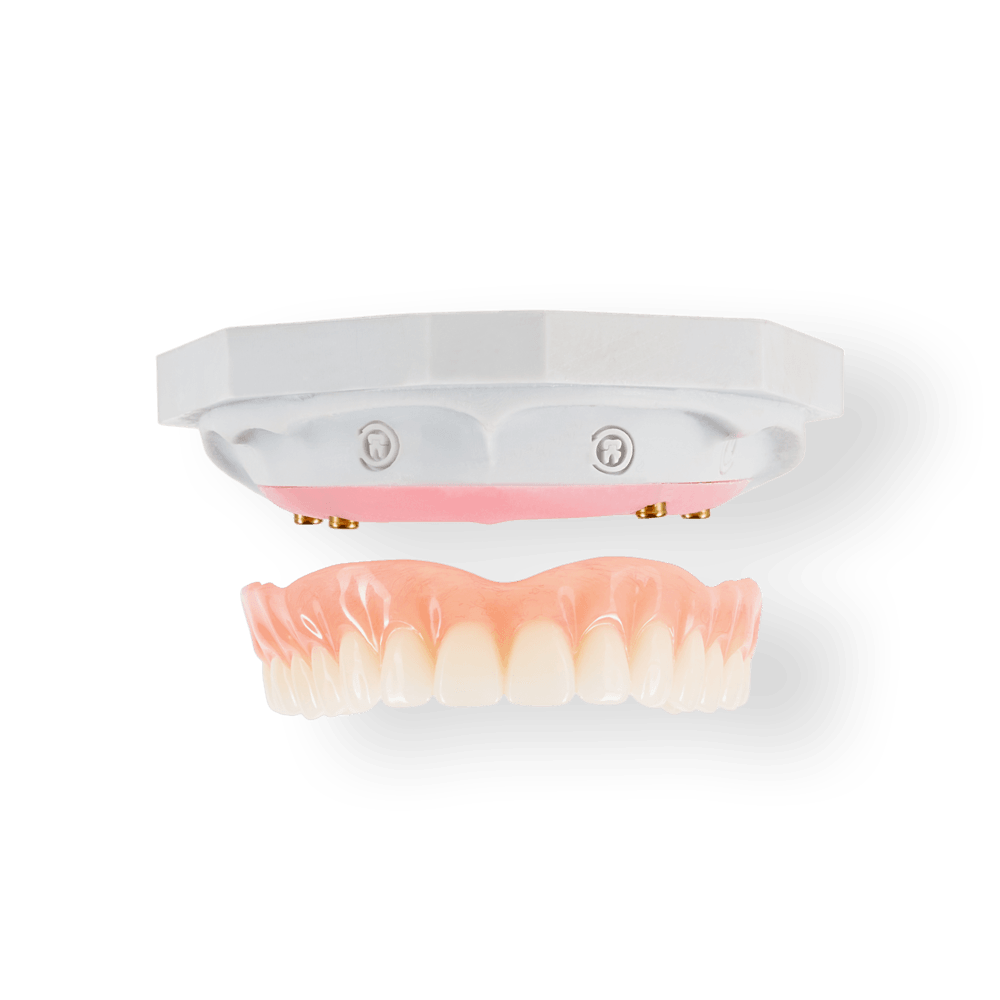 NeoSnap restoration