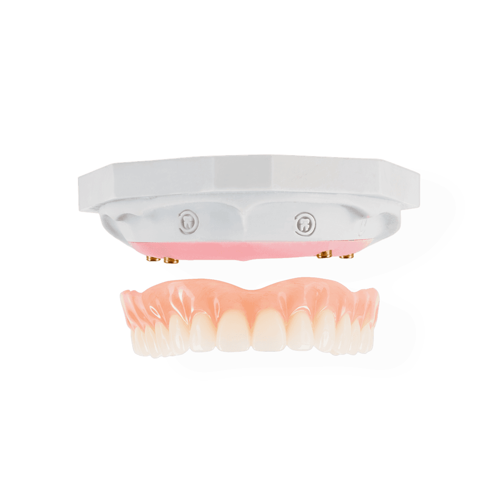 Snap-On Denture