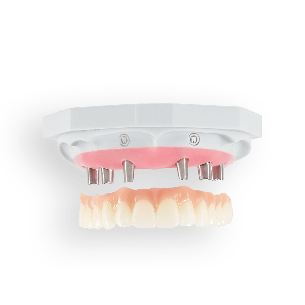 NeoSolidZir restoration