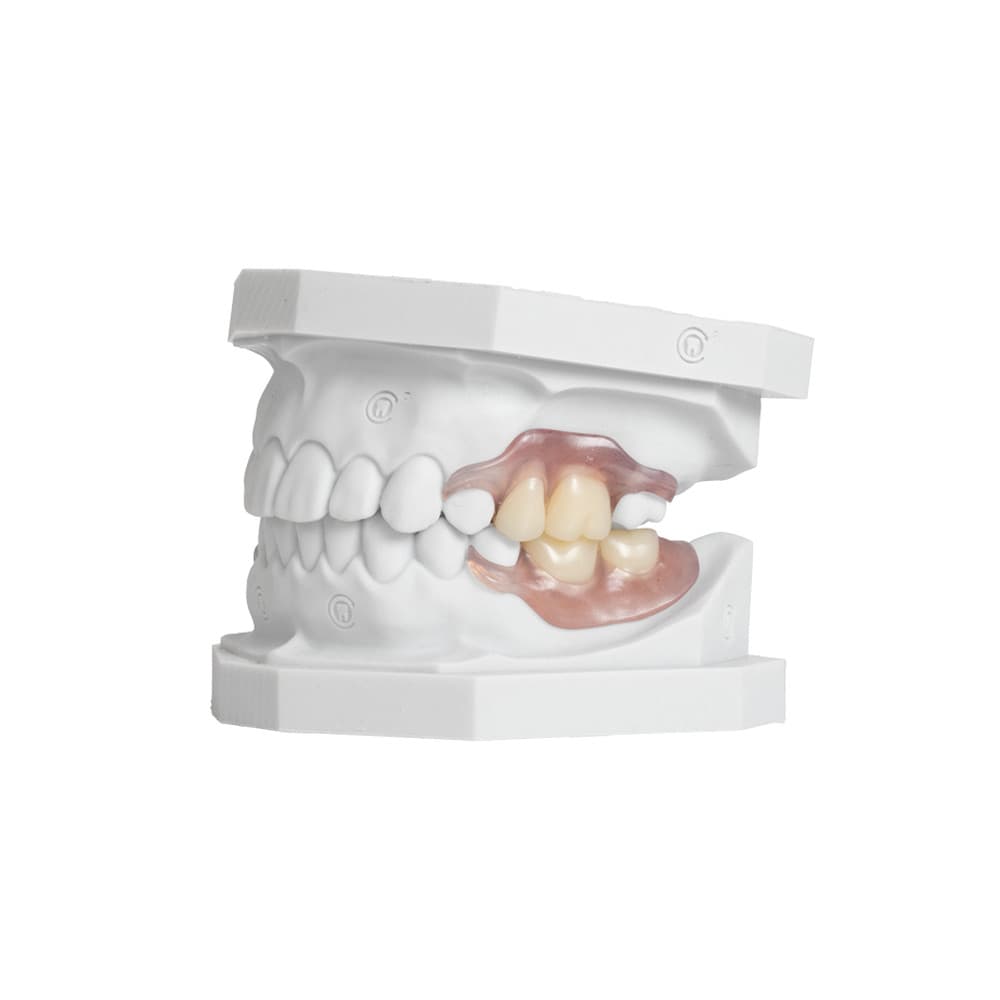 Flexible Partials (TCS™) gallery image 1