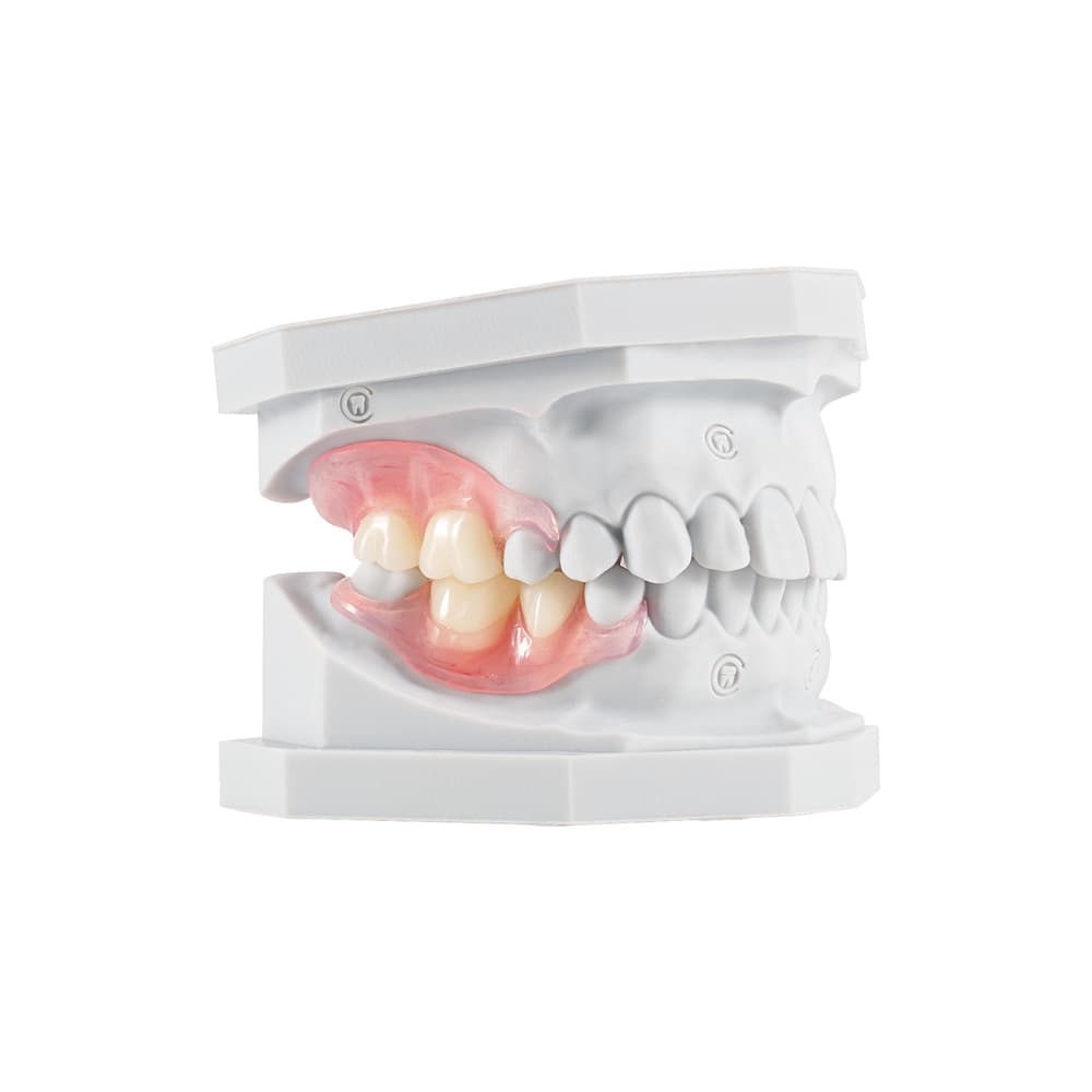 Flexible Partials (TCS™) gallery image 3
