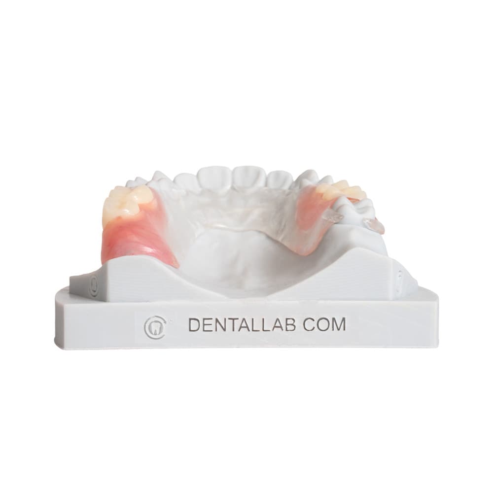 Flexible Partials (TCS™) gallery image 4