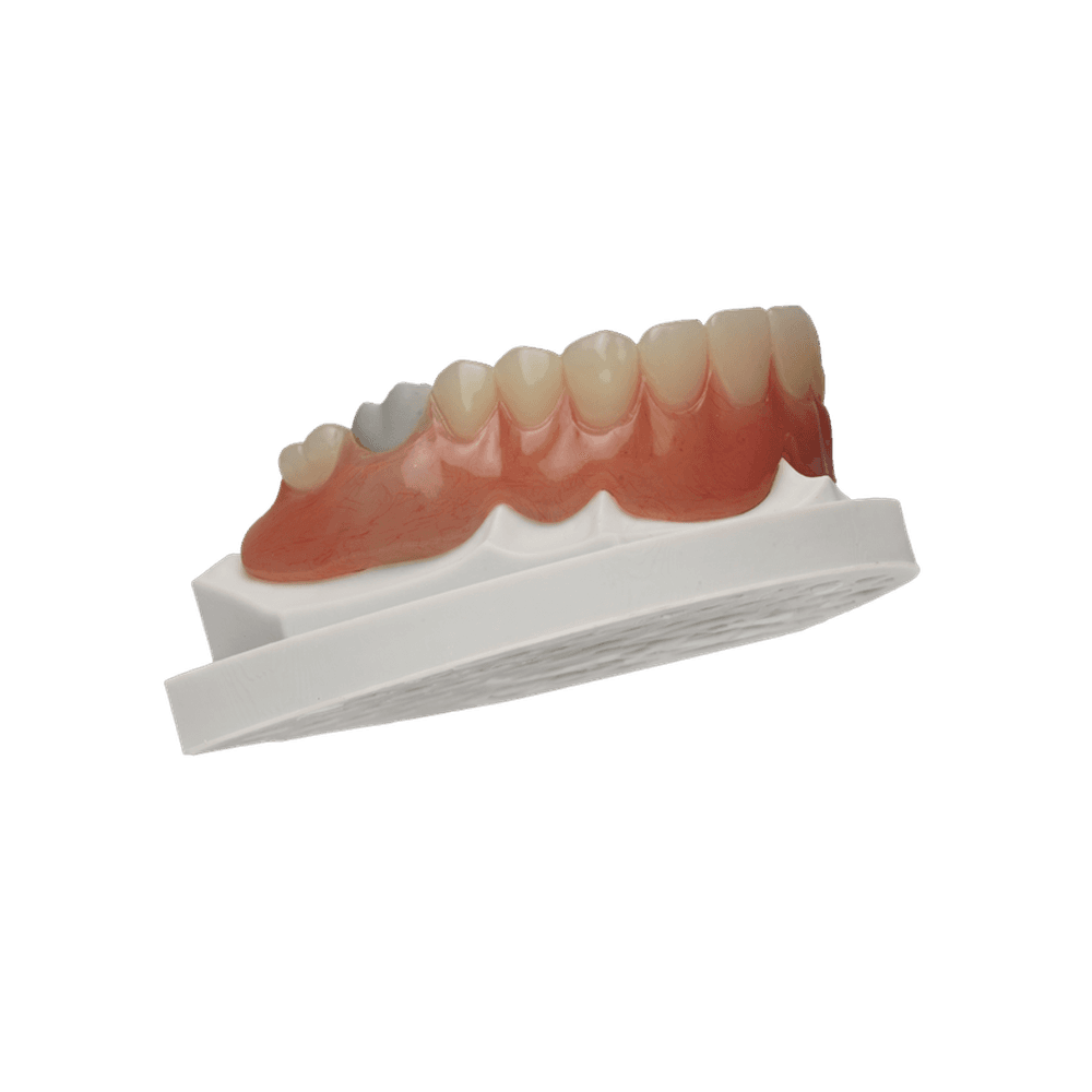Cu-Sil Denture