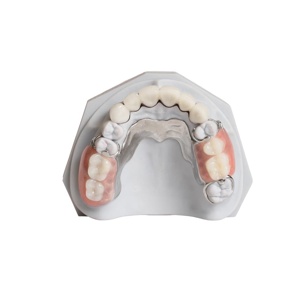 Partial Denture gallery image 4