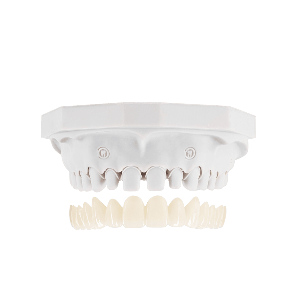 Crown and bridges restoration