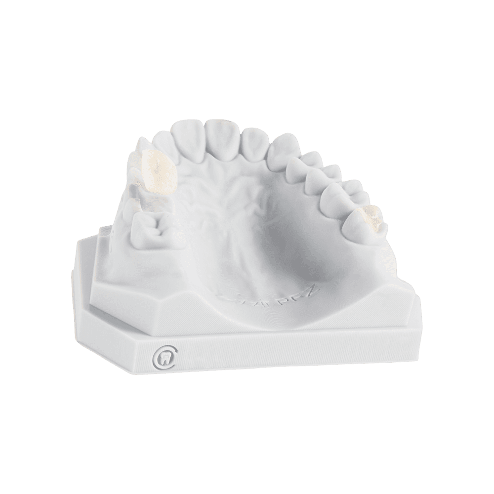 Dental inlays and onlays
