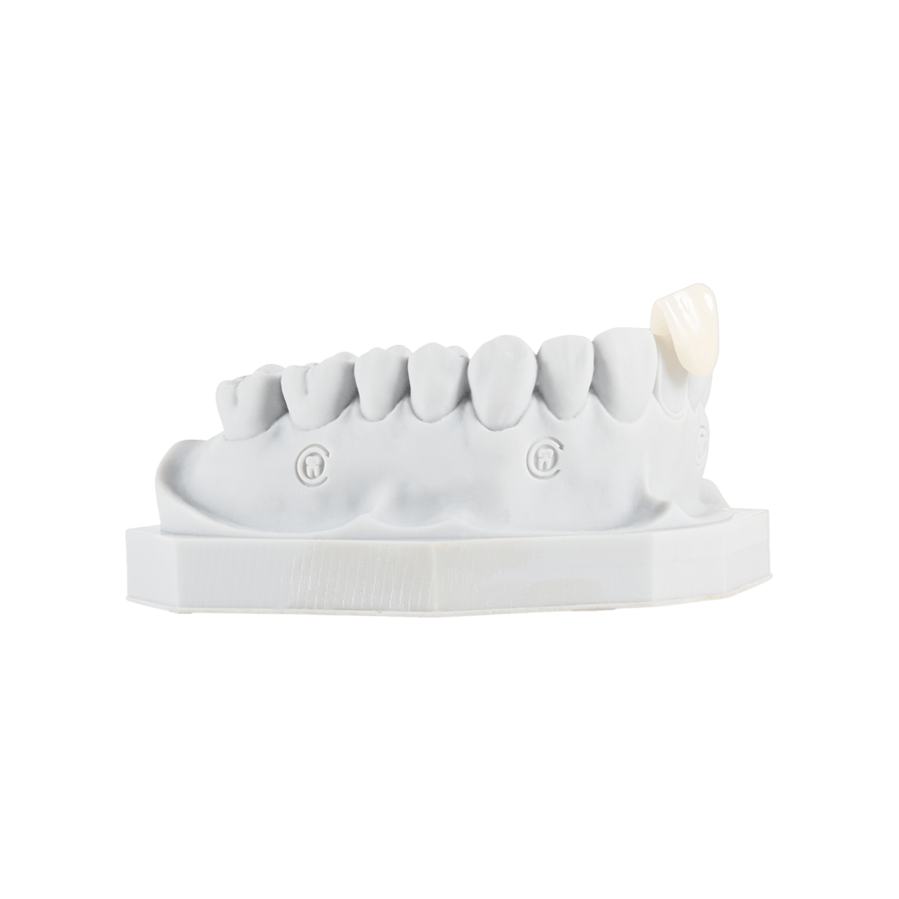 Jacket crown