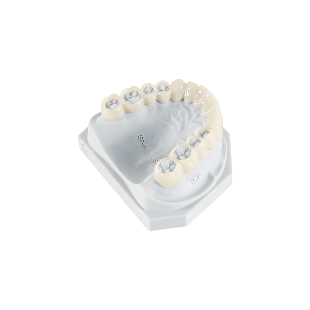 Snap-On Smile appliance