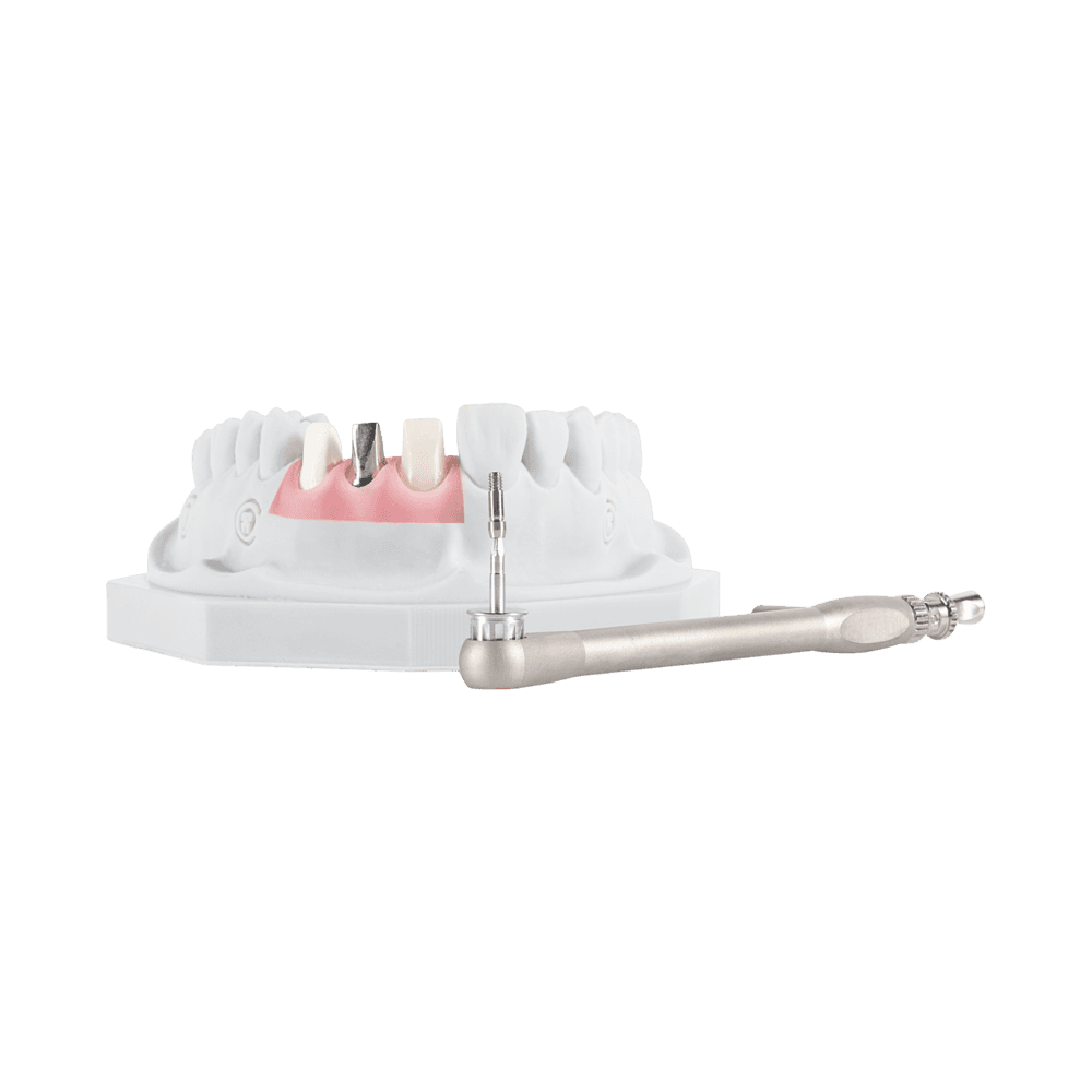 Cement-retained implant restoration