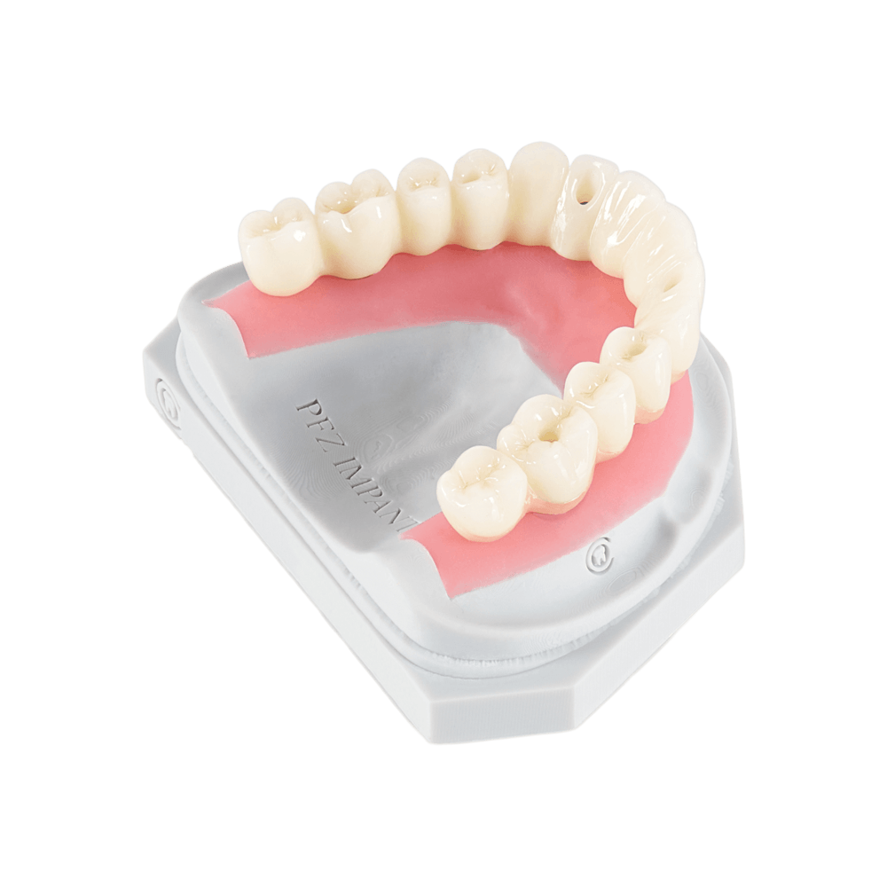 Custom implant abutments