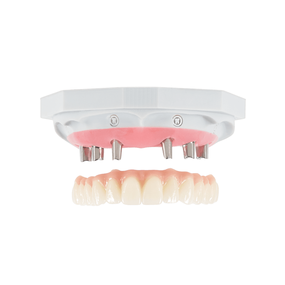 All-on-X full-arch implant