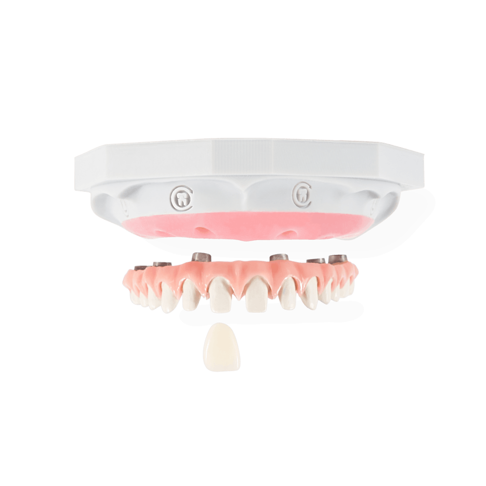 NeoGuide restoration