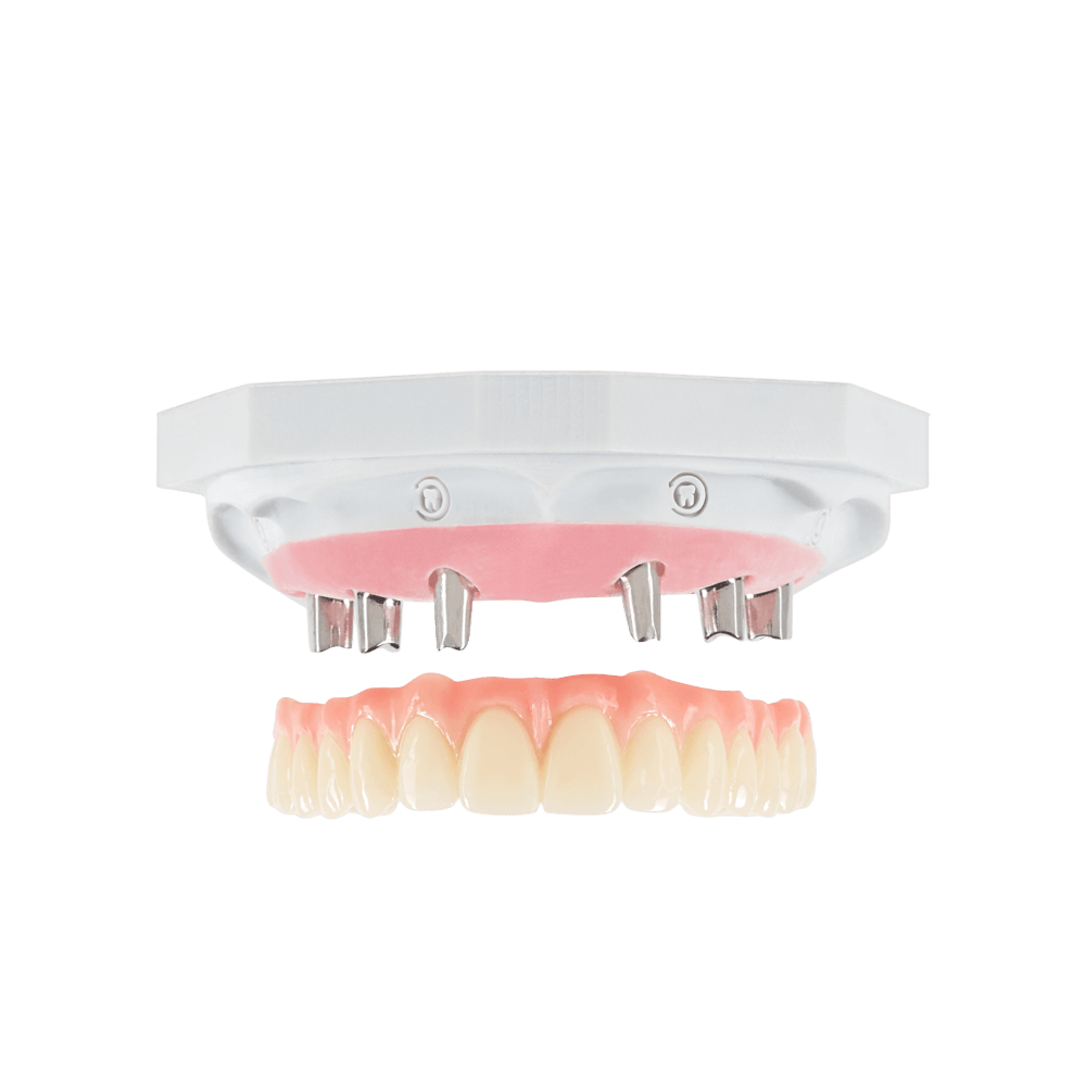 NeoSolidZir restoration
