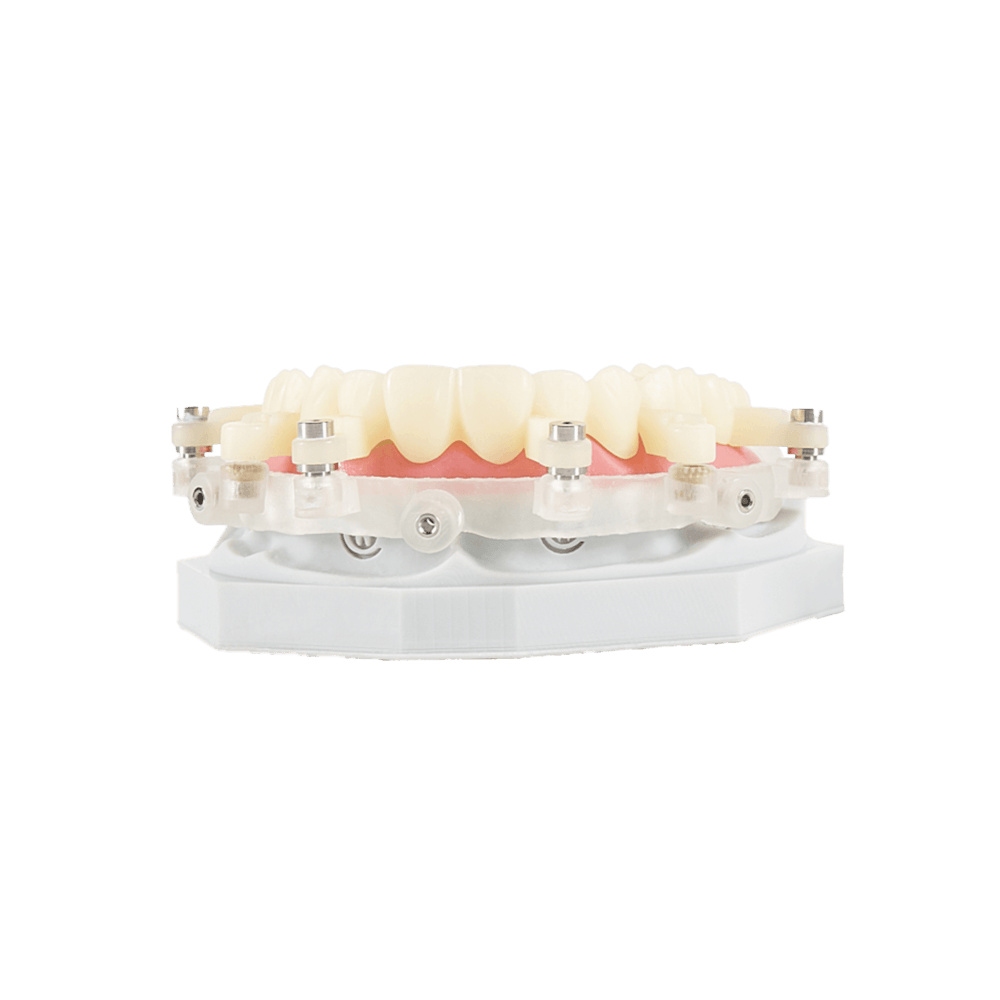 NeoGuide restoration
