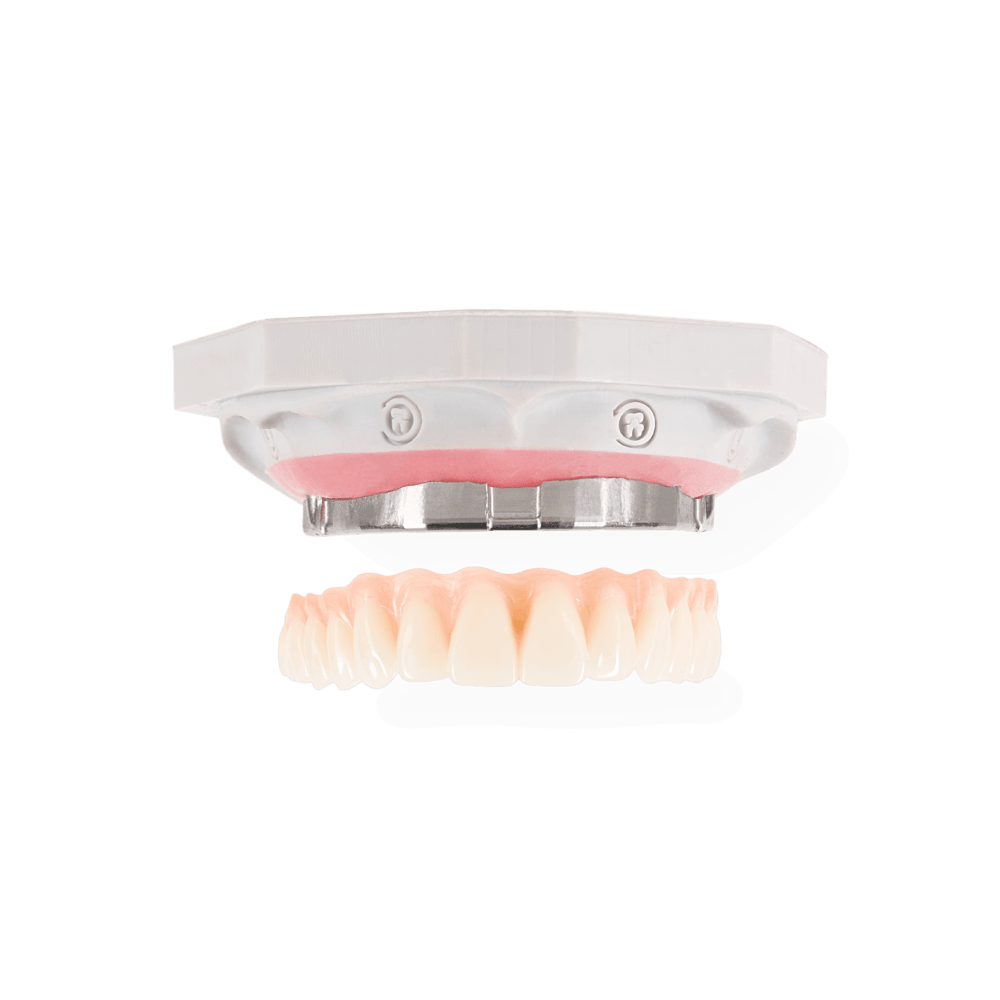 NeoClip restoration