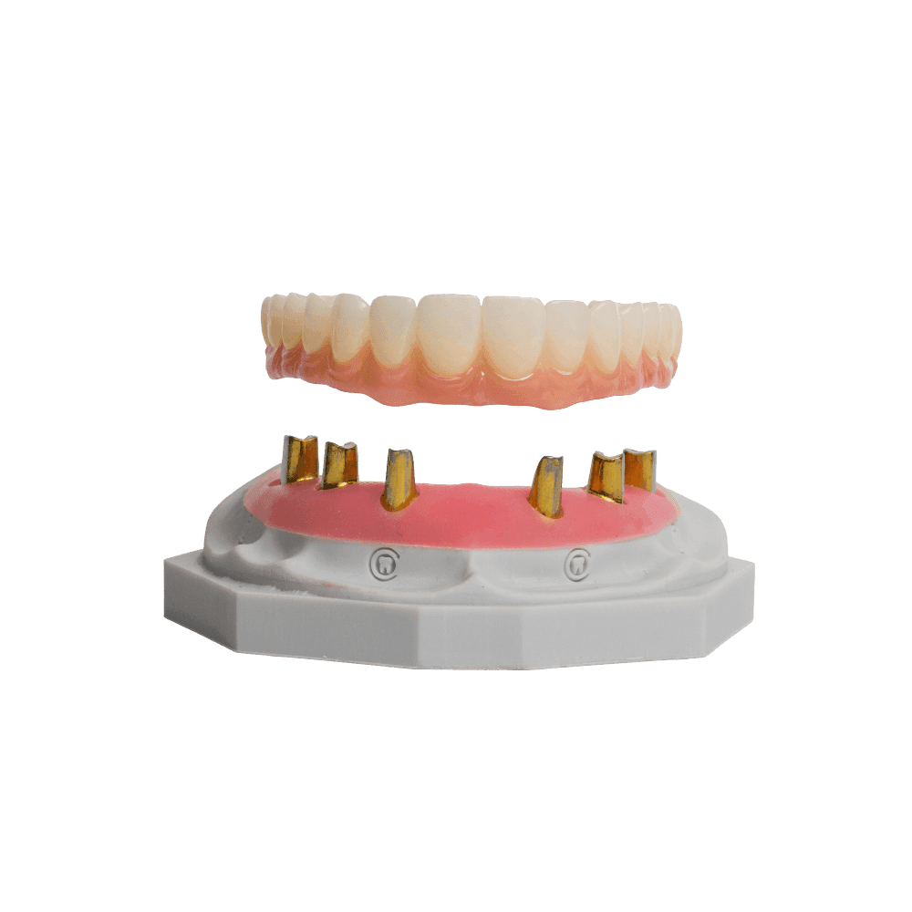 NeoSnap restoration