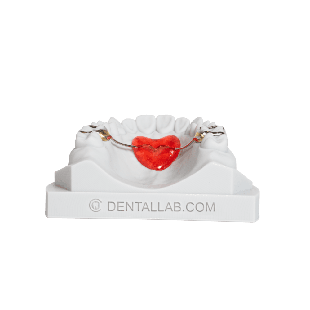 Orthodontic functional appliance